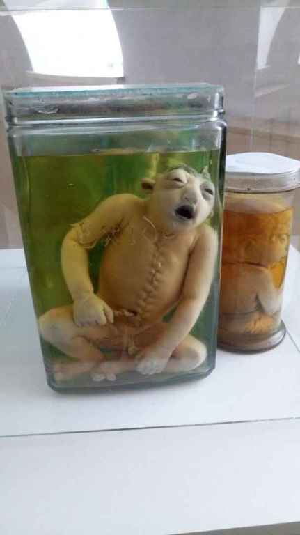 Medizinische Sammlung Semei